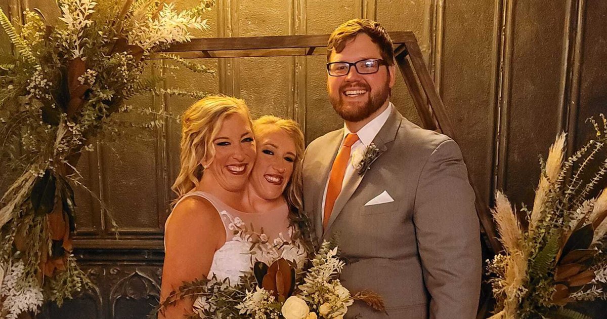 Conjoined Twins Abby and Brittany Hensel Clap Back After Wedding News