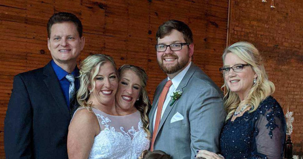 Conjoined Twin Abby Hensel Shares Wedding Dance With Josh Bowling